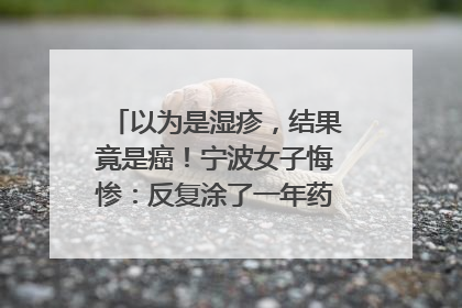 以为是湿疹，结果竟是癌！宁波女子悔惨：反复涂了一年药膏都没好！很多患者首诊都去了皮肤科
